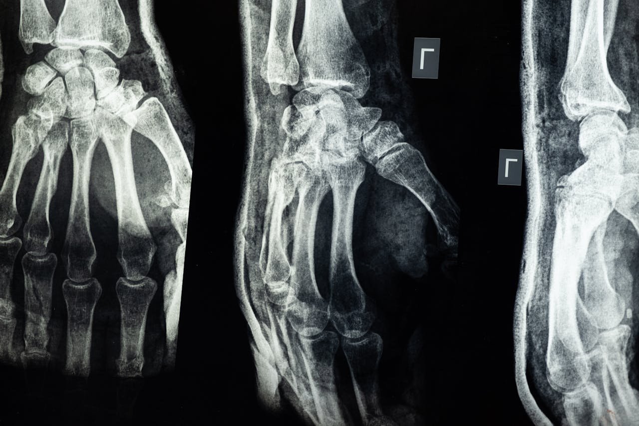 Close-up X-ray showing detailed view of human hand bones.